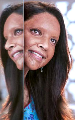 Chhapaak (hindi) reviews
